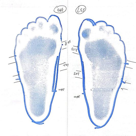 靴に加え、固有受容器アイラーゲンを使用し、更なる変化へ