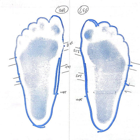 靴に加え、固有受容器アイラーゲンを使用し、更なる変化へ