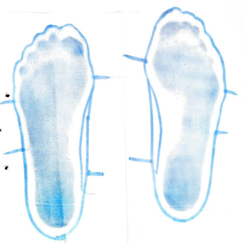 「身体のプロ」が実感。固有受容器インソールで扁平足の改善！