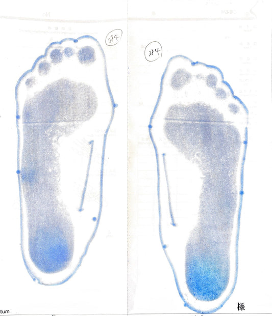 扁平足の改善で、姿勢にも良い影響が