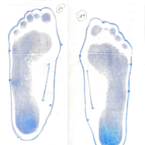 扁平足の改善で、姿勢にも良い影響が