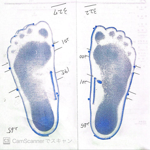 ご両親が扁平足でお悩み。お子様の足が心配でご来店。