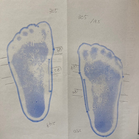 フットプリント